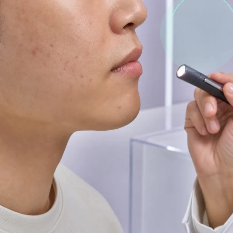 부산피부과 땀과 마찰 위치로 읽는 여드름 유사 발진 | 부산피부과 정보 대표 이미지